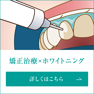 矯正治療×ホワイトニング　詳しくはこちら